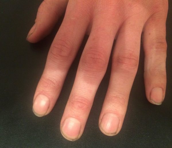 Katie Barnes man before