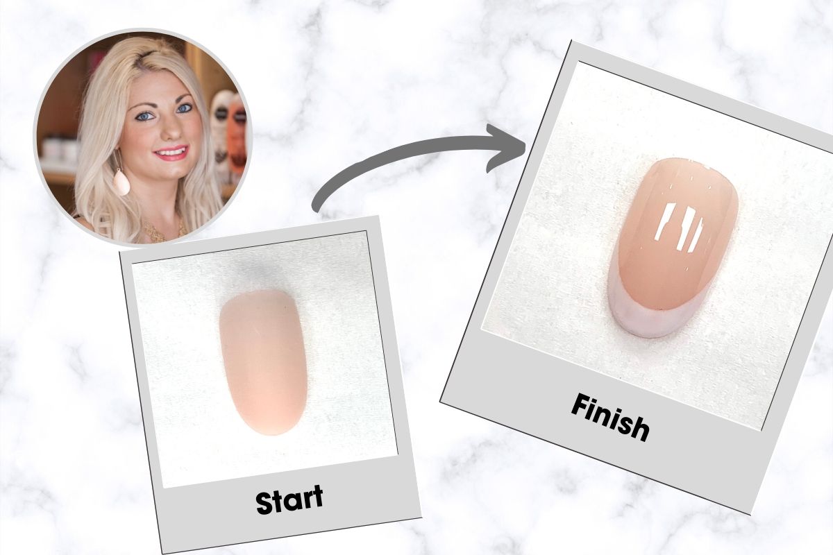 Katie Barnes smile gel