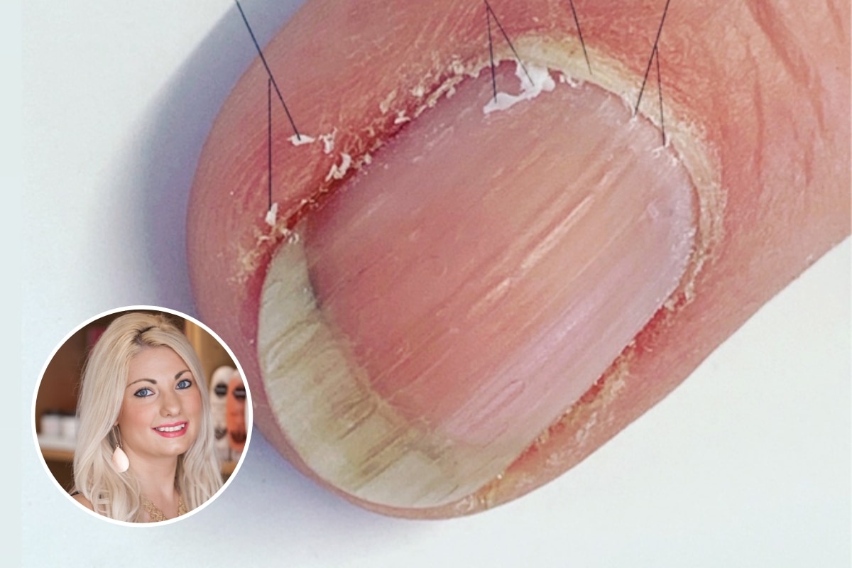 Katie Barnes cuticle feature