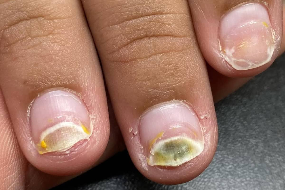 Instagram.com:nailsavvyy greenies nails is it mould