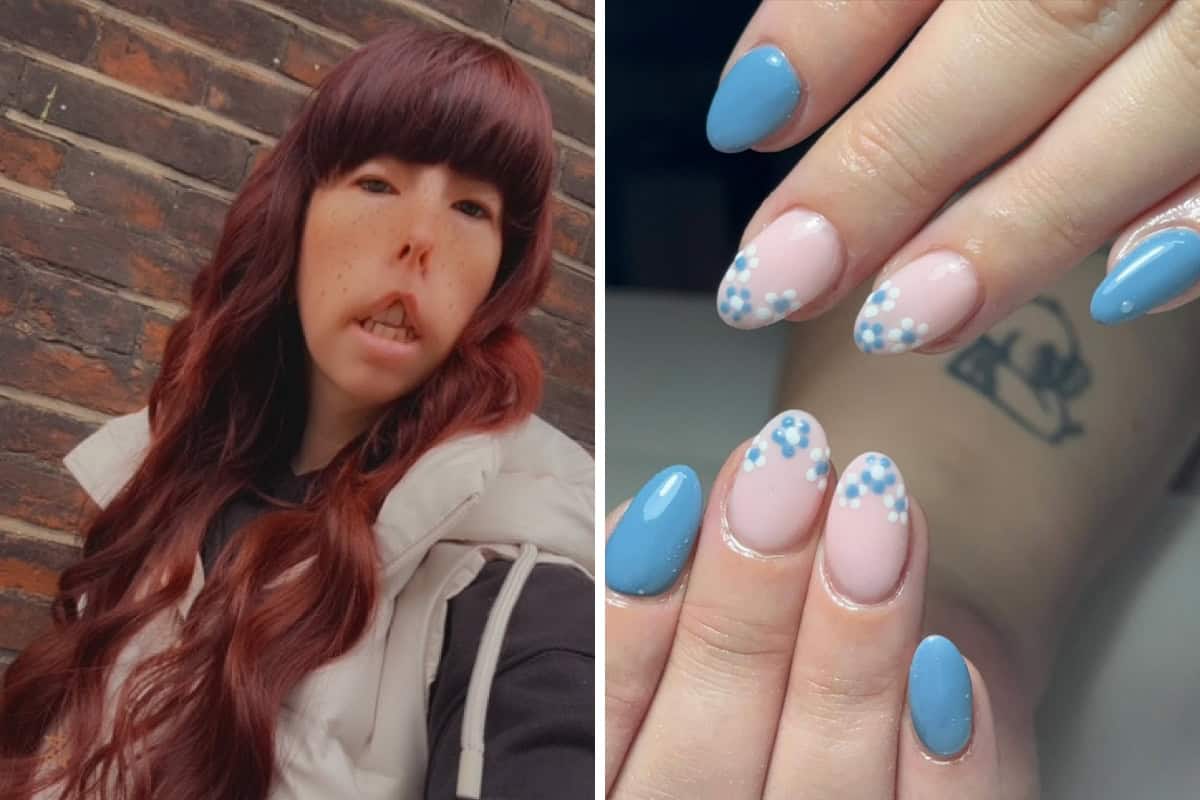 Jade fox nail tech with moebius syndrome